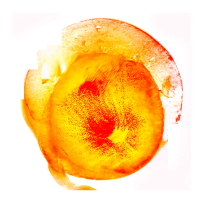 Cysticercus thumbnail