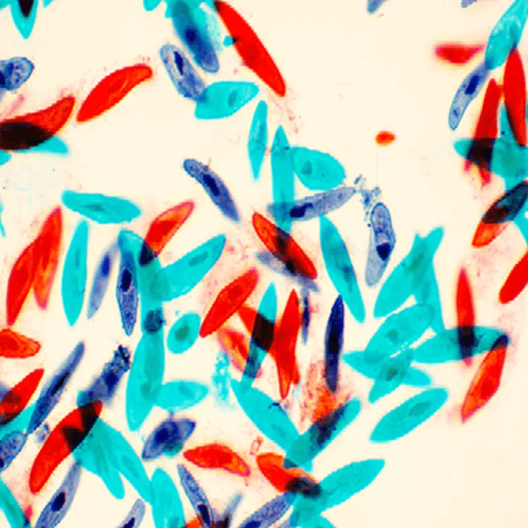 Paramecium thumbnail