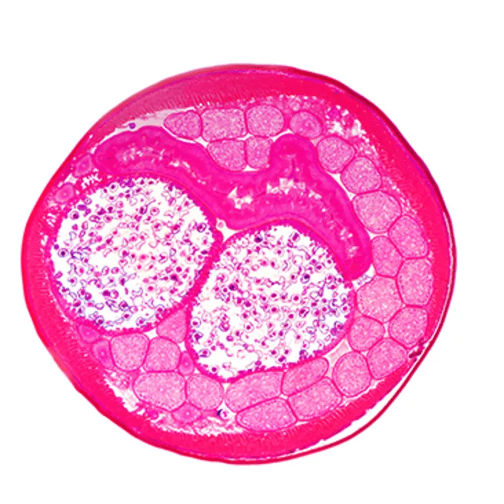 Female Ascaris lumbricoides thumbnail